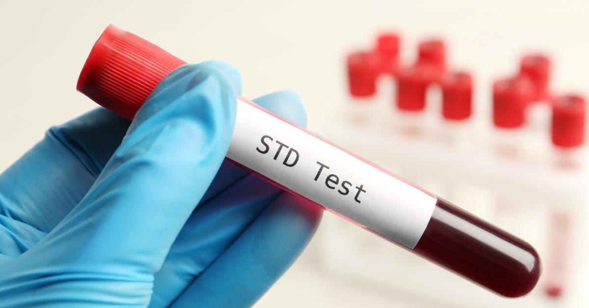 The Important of Std Test Bali